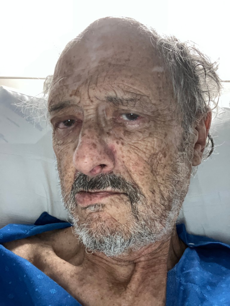 To show how hospitalization can make even a handsome, suave, sophisticated guy like me look like shit.